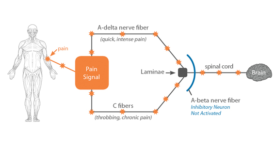 How does Electrotherapy works