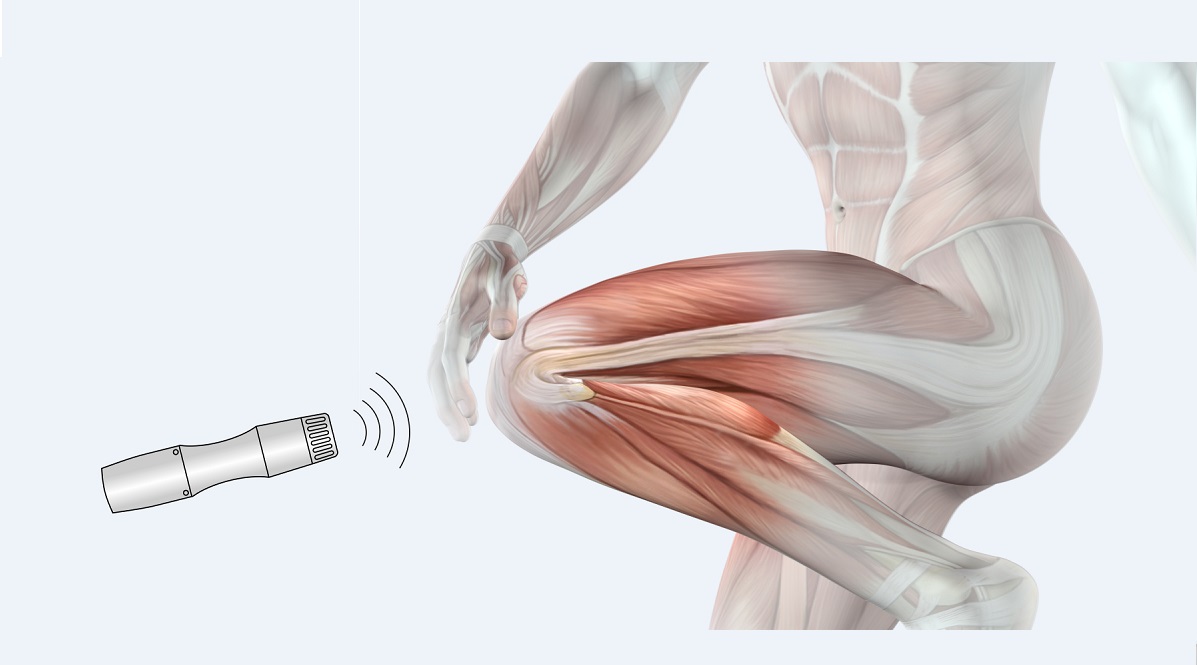 Shockwave Therapy: Blast Medwave for Pain Relieve - Johari Digital